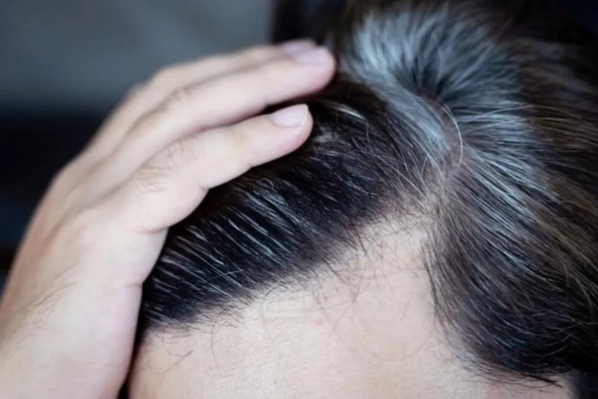 Repigmentasi rambut lebih mungkin pada uban awal. dr. Adam menjelaskan hubungan stres, metabolisme rambut, dan kembalinya warna.