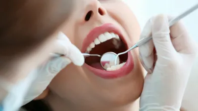 Mikrobioma Oral Berpengaruh pada Penyakit Gusi dan Jantung