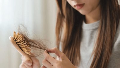Rambut Rontok Gen Z Meningkat, Tekanan Sosial Jadi Ancaman Nyata